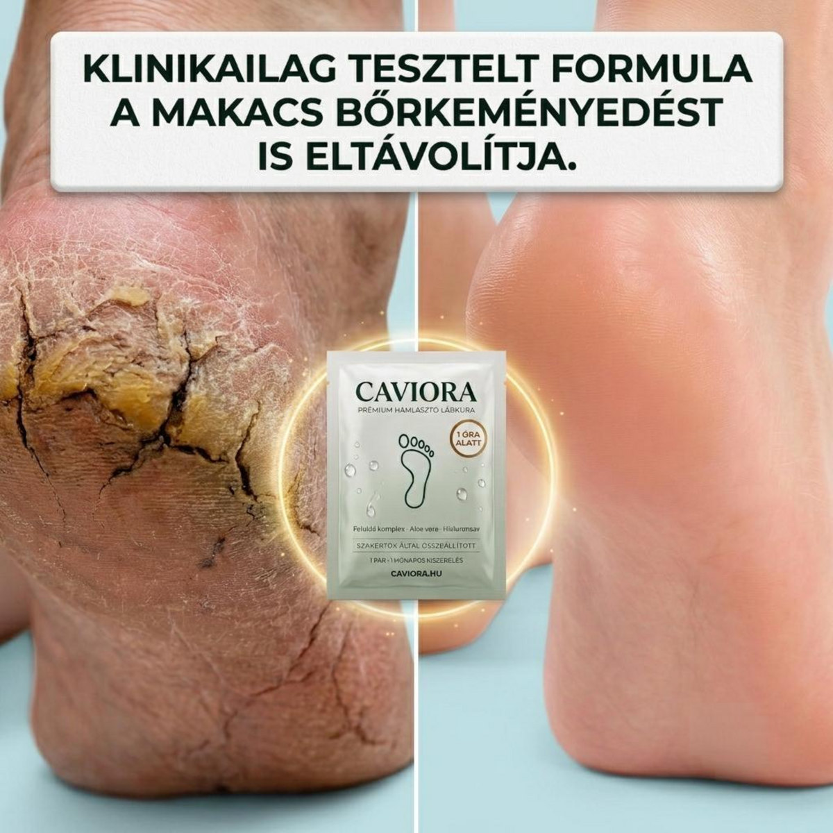 Caviora — Puha sarok pár nap alatt, egy órás otthoni kúrával