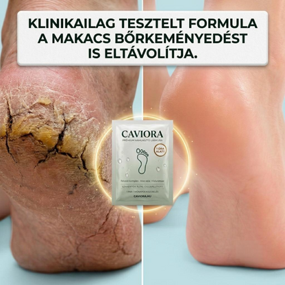 Caviora — Puha sarok pár nap alatt, egy órás otthoni kúrával