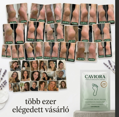 Caviora — Puha sarok pár nap alatt, egy órás otthoni kúrával